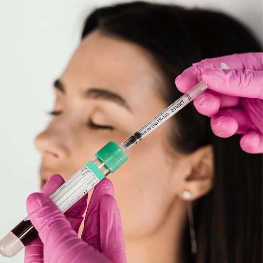 PRP gezichtsbehandeling