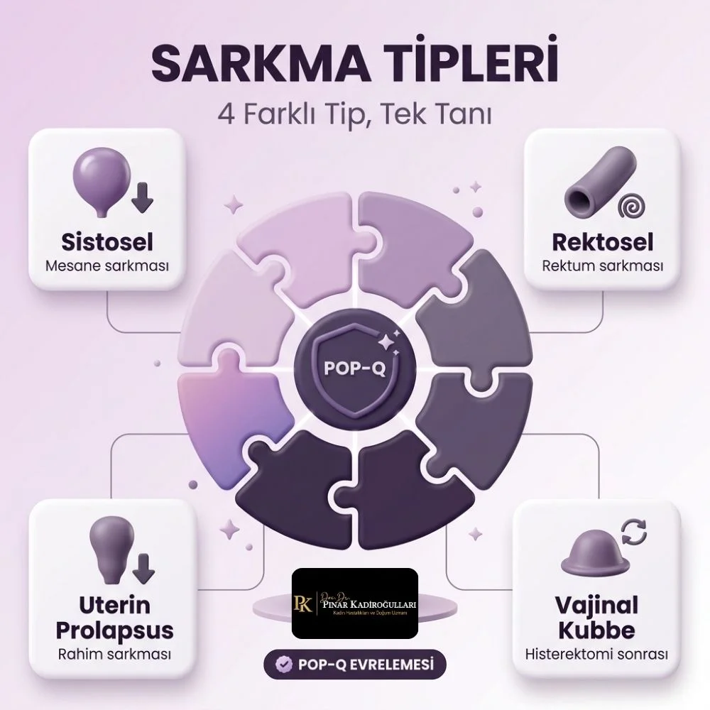 Pelvik organ sarkmasi Kadınlar Kulübü
