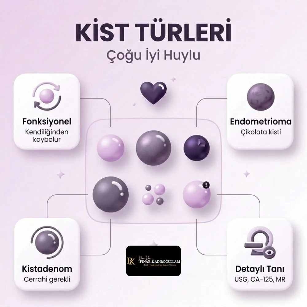 sol yumurtalık kisti belirtileri