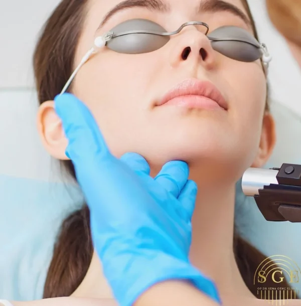 Double Chin Laser Liposuction in turkey